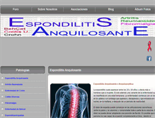 Tablet Screenshot of espondilitis.eu